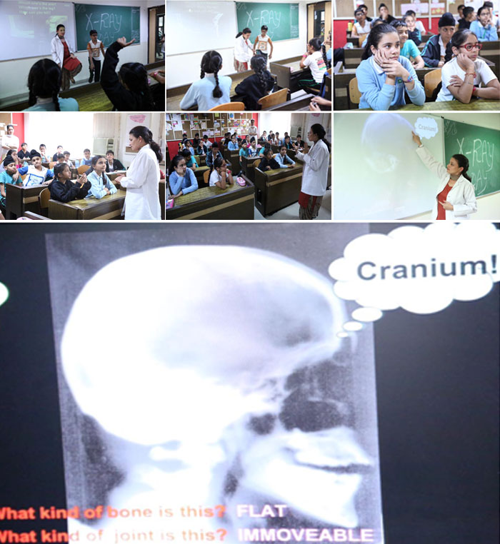 x-ray-day